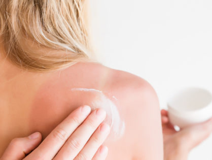 Recette pour soigner les coups de soleil