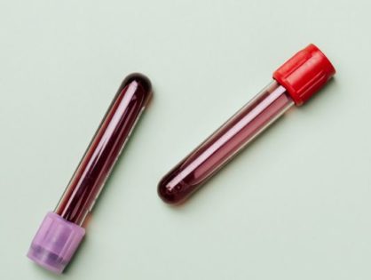 Définition du don de sang et contre-indications au don